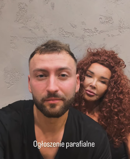 Zdjęcie Katastrofa przed startem „Tańca z Gwiazdami”! Eva Minge złamała żebra #1