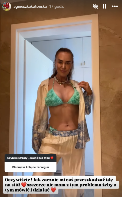 Zdjęcie "Nie chcę starzeć się 'z godnością'" - Agnieszka Kotońska szczerze o operacjach plastycznych #2